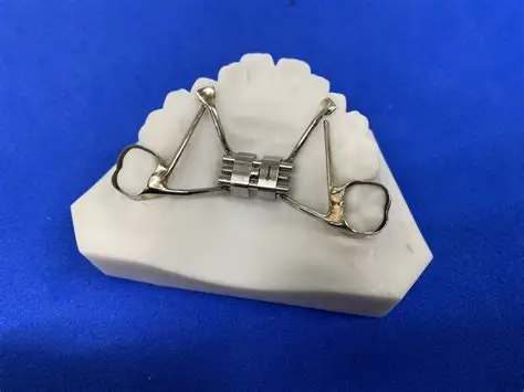 上顎側方拡大装置